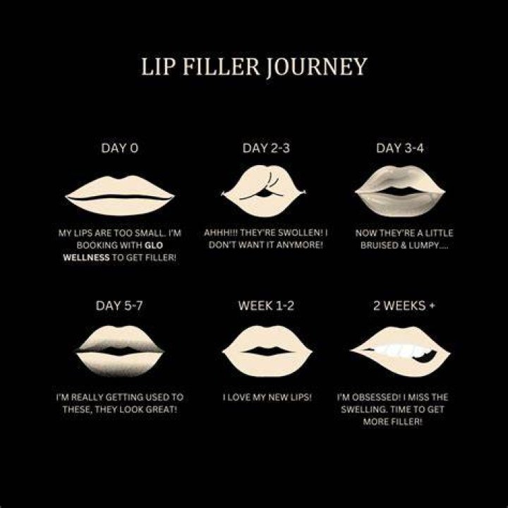 All About Alanna Panday's Lip Filler Journey