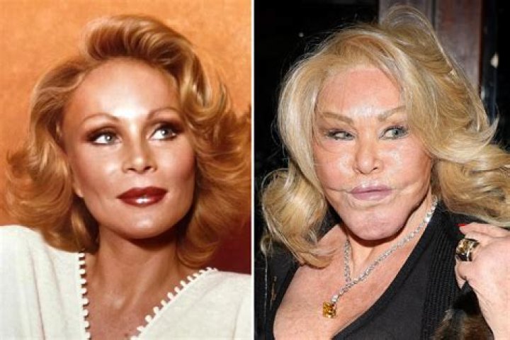 Jocelyn Wildenstein: The Enigmatic Transformation Before Plastic Surgery