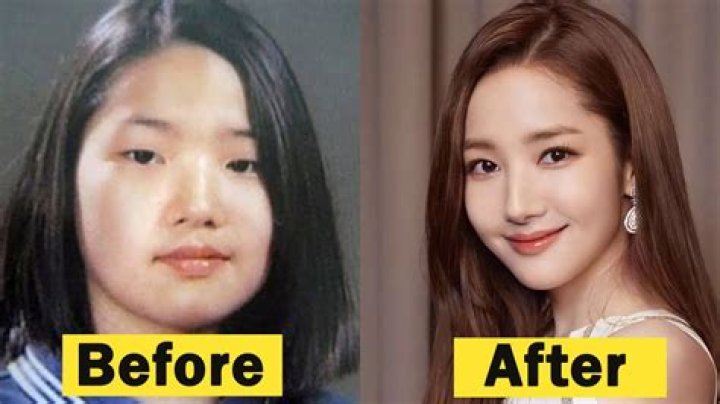 Lee Jae-wook Plastic Surgery: Unveiling the Truth Behind the Transformation