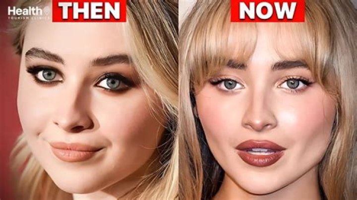 Sabrina Carpenter Nose Job: The Truth Behind Her Transformation