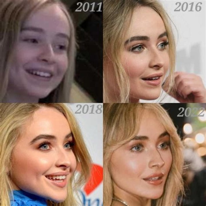 Sabrina Carpenter Nose: The Evolution of Her Look