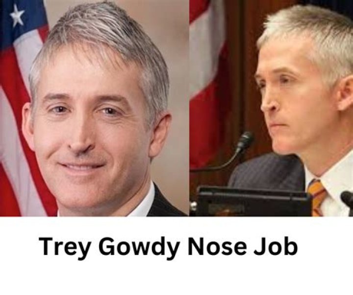 Trey Gowdy's Nose: A Closer Look at the Man Behind the Features