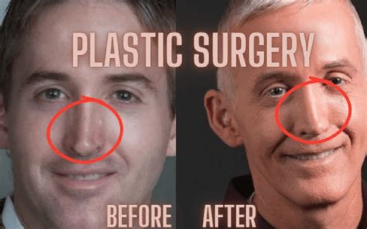 Trey Gowdy's Nose Surgery: A Closer Look at the Changes