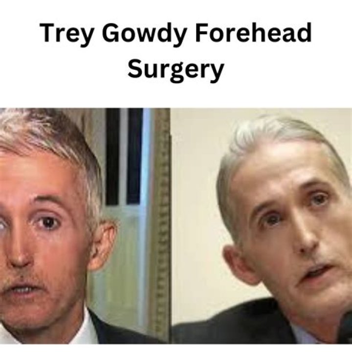Trey Gowdy's Transformation: The Truth Behind His Face Surgery