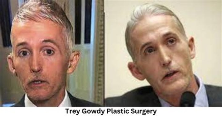 Trey Gowdy's Transformation: Unveiling the Truth Behind His Plastic Surgery Rumors