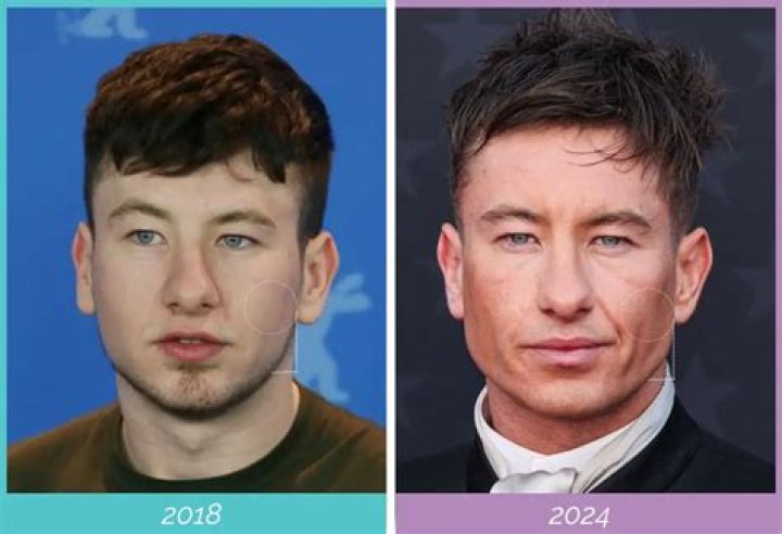 Understanding Barry Keoghan's Ethnicity: Is Barry Keoghan Asian?