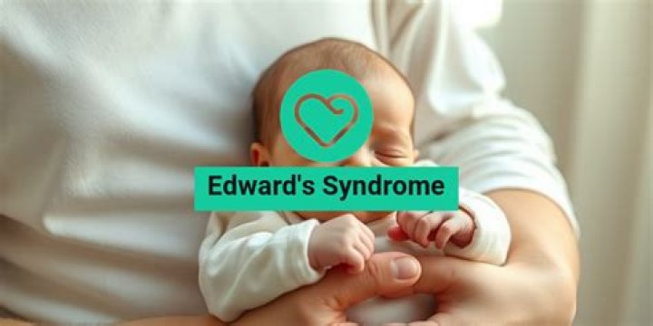 Understanding Edward Bluemel Syndrome: Causes, Symptoms, and Management