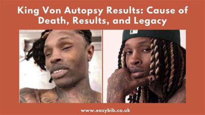 Unraveling the Mystery Behind King Von Autopsy Photos