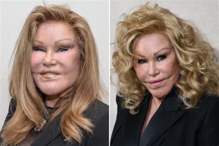 Unveiling Jocelyn Wildenstein: A Journey Through Transformation