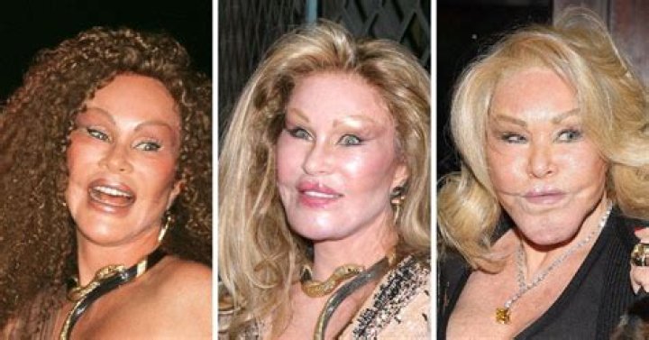 Unveiling the Life of Jocelyne Wildenstein: The Catwoman of New York
